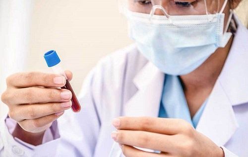 Bác sĩ thực hiện các xét nghiệm cận lâm sàng để đưa ra kết luận chẩn đoán bệnh tiểu đường