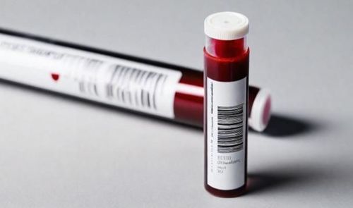 Định lượng NT-proBNP trong xét nghiệm suy tim thường dùng để chẩn đoán, sàng lọc tim và đánh giá tình trạng bệnh hiện tại