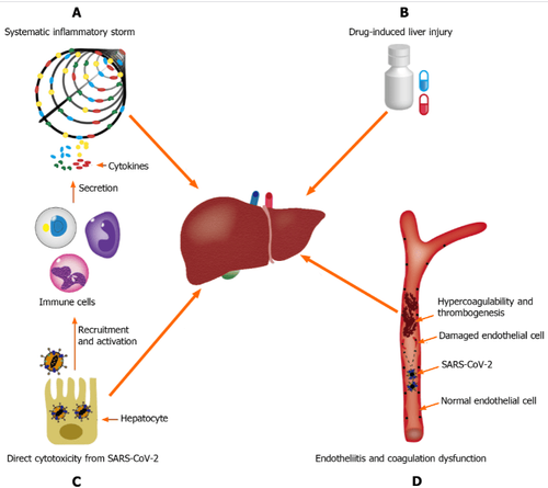 Hình 1. Các cơ chế cơ bản của bệnh do coronavirus gây ra-tổn thương gan do coronavirus-19
