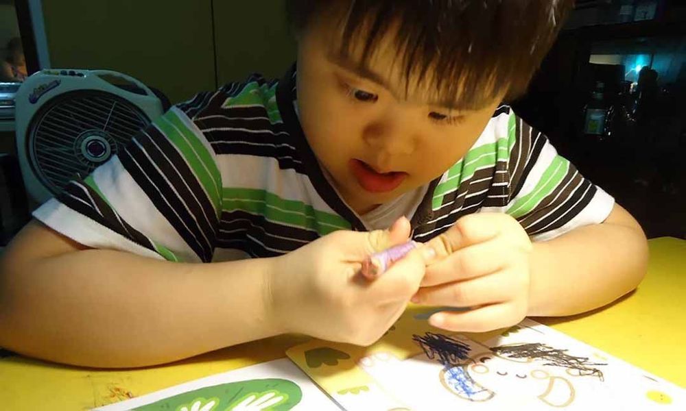 Cao prolin tuýp 2 có thể kèm triệu chứng chậm phát triển trí tuệ nhẹ đi cùng co giật.